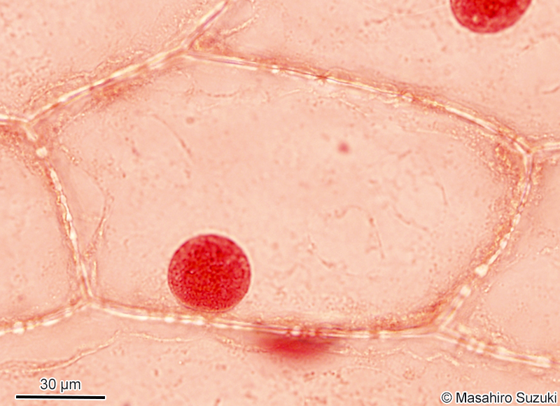 酢酸オルセイン溶液で染色したタマネギの表皮細胞