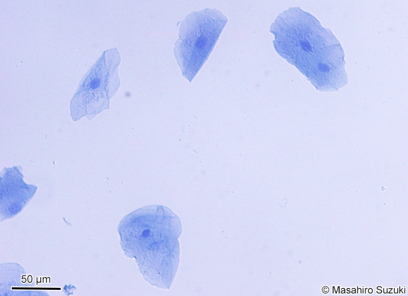 1.0%アニリンブルー水溶液で染色した口腔上皮細胞
