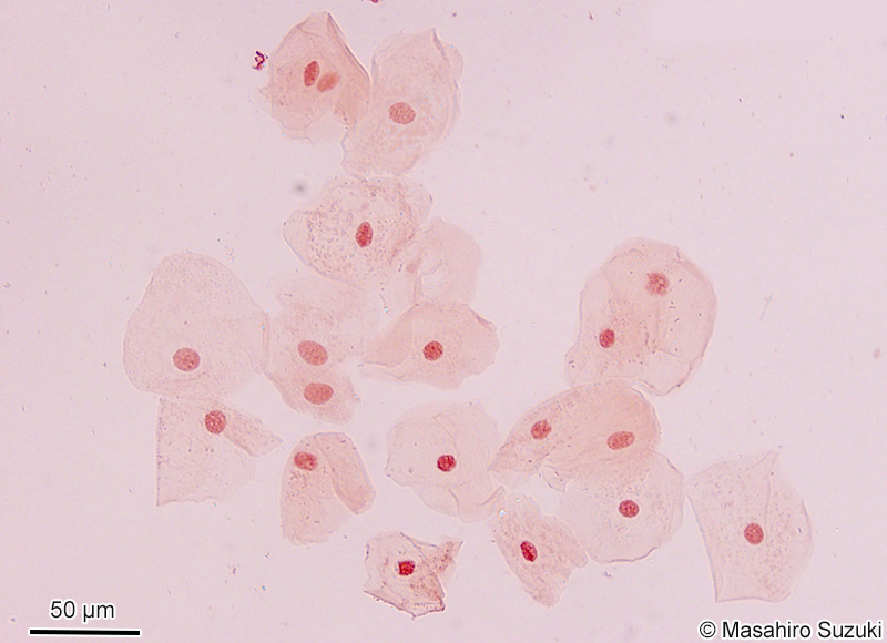 酢酸オルセイン溶液で染色した口腔上皮細胞