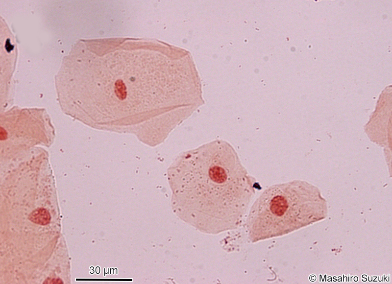 酢酸オルセイン溶液で染色した口腔上皮細胞