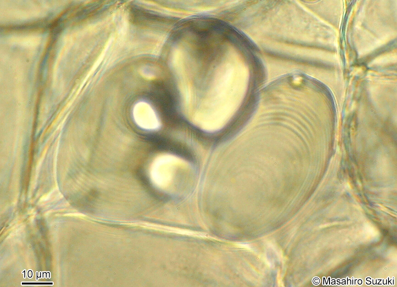 ジャガイモのアミロプラスト