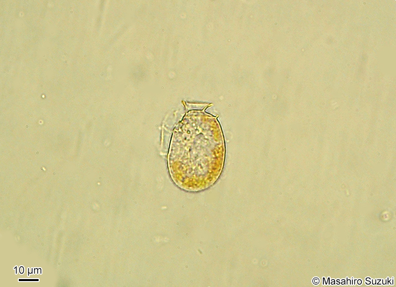 Dinophysis sp.