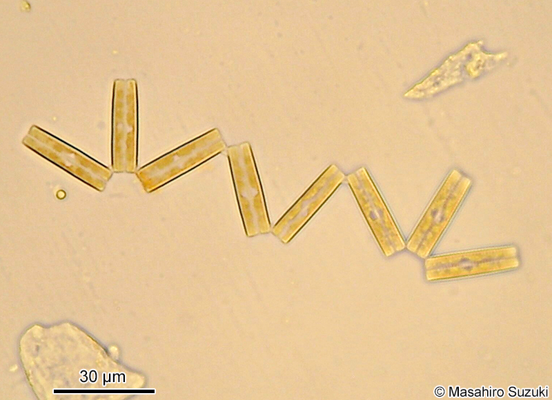 ハリオカメケイソウ Neodelphineis silenda