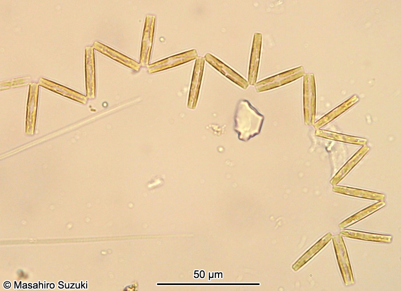 ハリオカメケイソウ Neodelphineis silenda