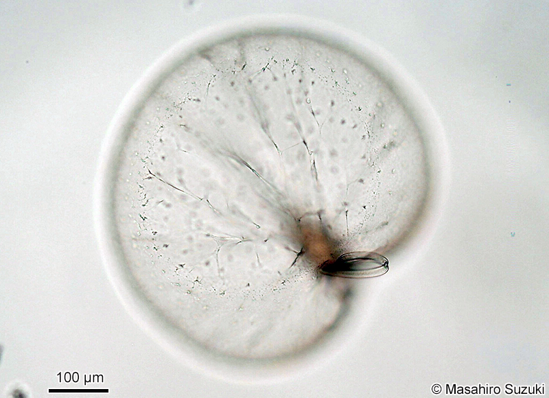 ヤコウチュウ Noctiluca scintillans