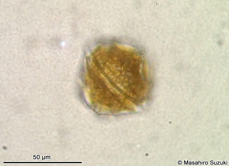 Peridinium sp.