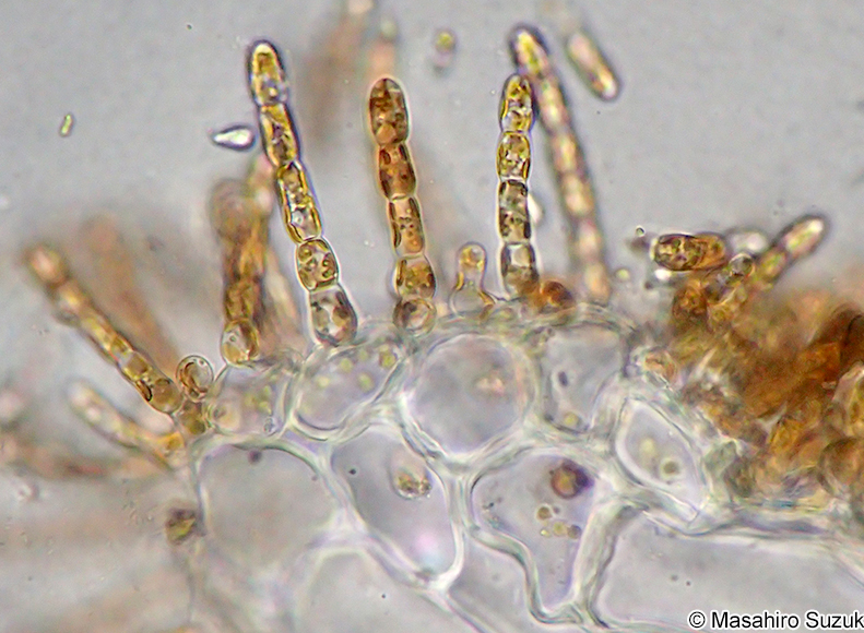 ニセモズク Acrothrix pacifica