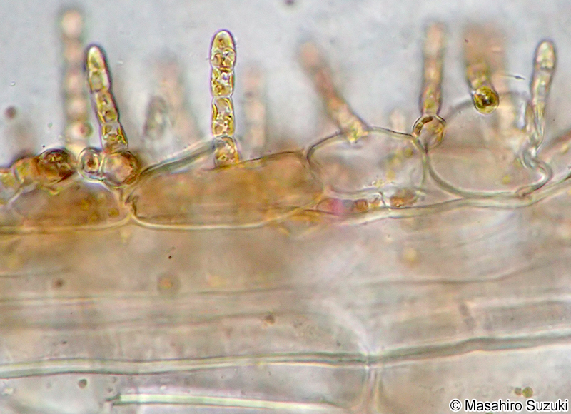 ニセモズク Acrothrix pacifica