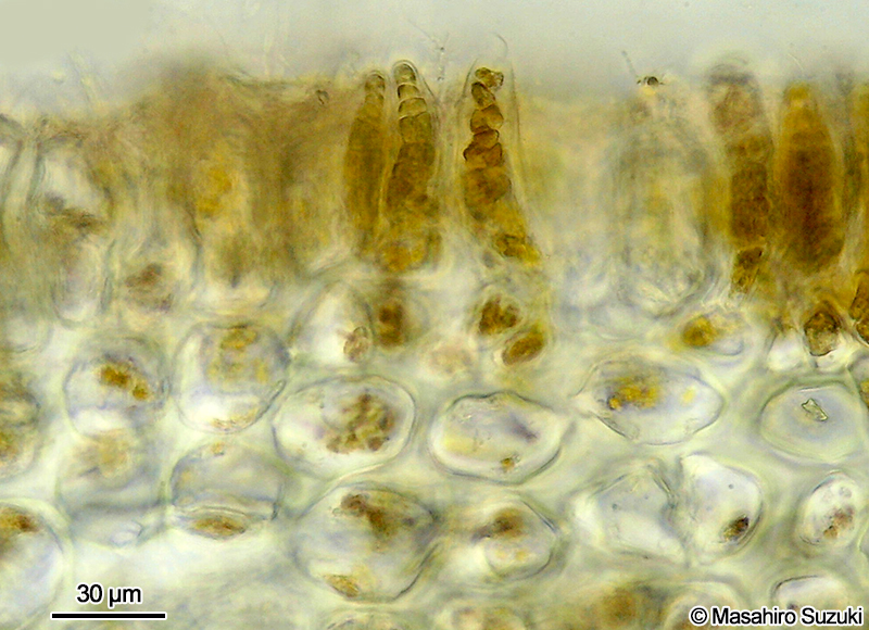 複子嚢を付けた体の横断面