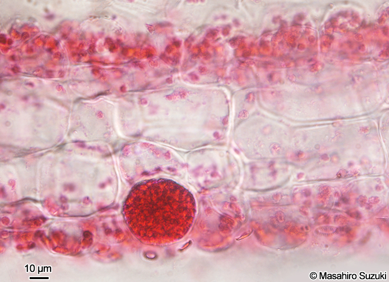 単子嚢を付けた体の横断面