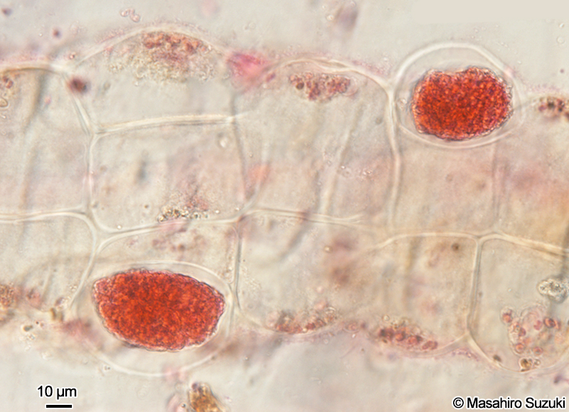 単子嚢を付けた体の横断面