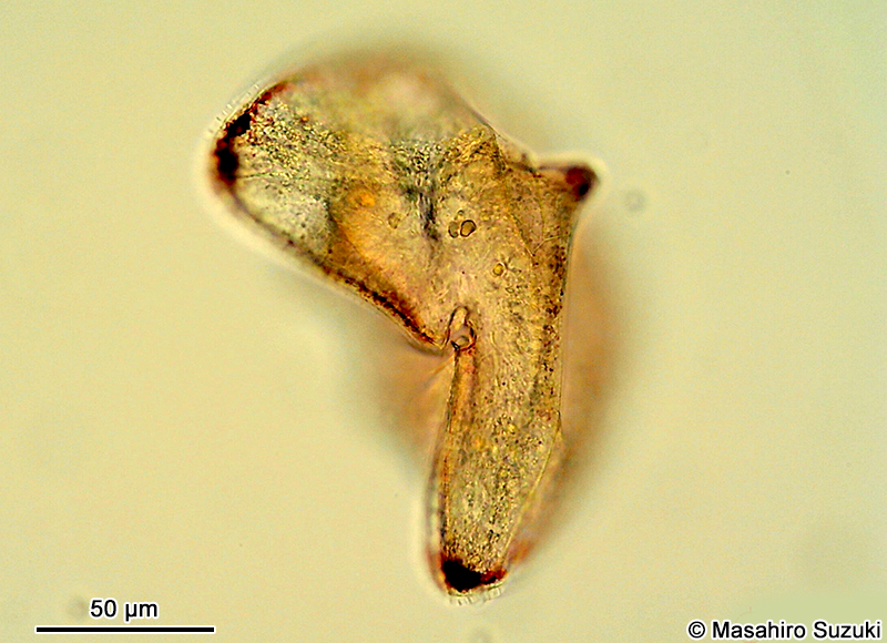 Protoperidinium sinuosum