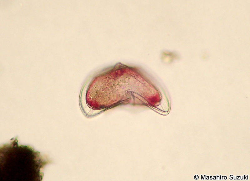 Protoperidinium sinuosum