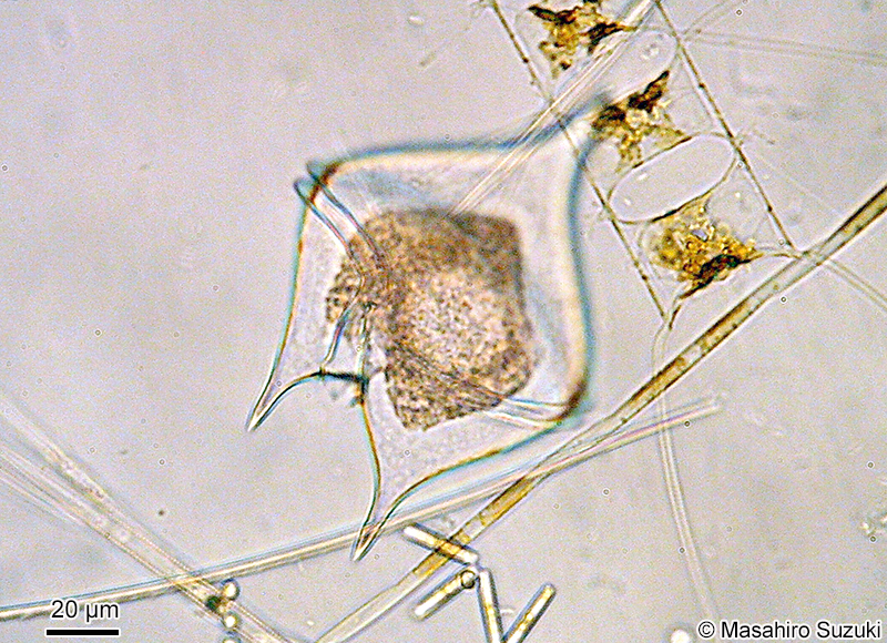 Protoperidinium sp.3