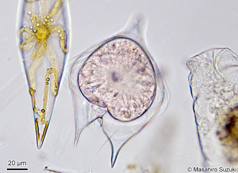 Protoperidinium sp.3