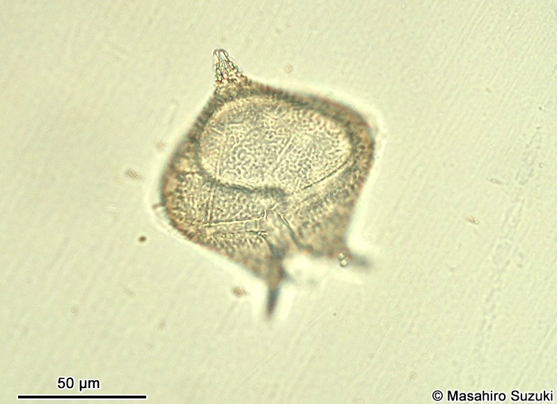 Protoperidinium sp.