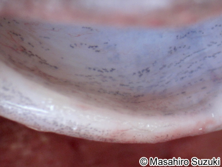 アフリカツメガエルの下顎