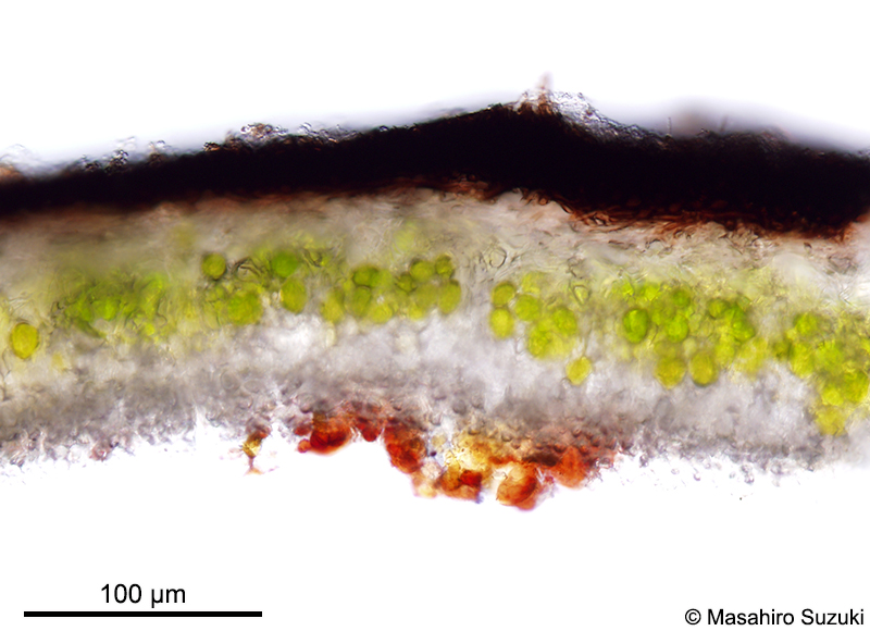 ムカデゴケ科の横断面