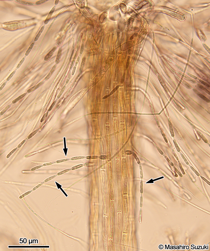 二次輪生枝（矢印）