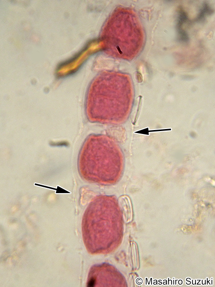 タマノイト Trailliella intricata