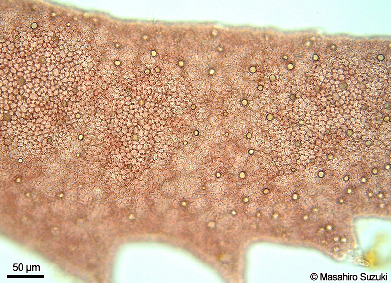 タマイタダキの腺細胞