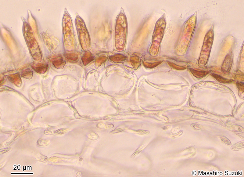 配偶体の横断面