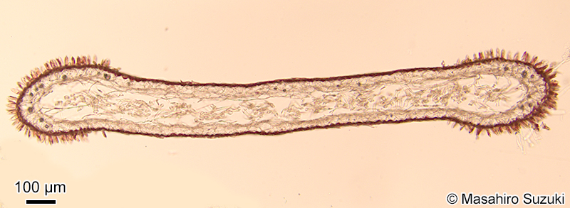 配偶体の横断面