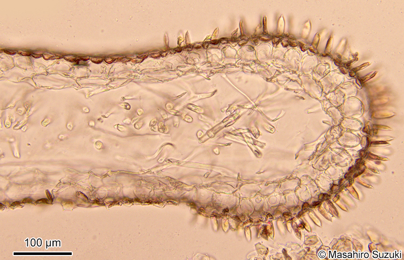 配偶体の横断面