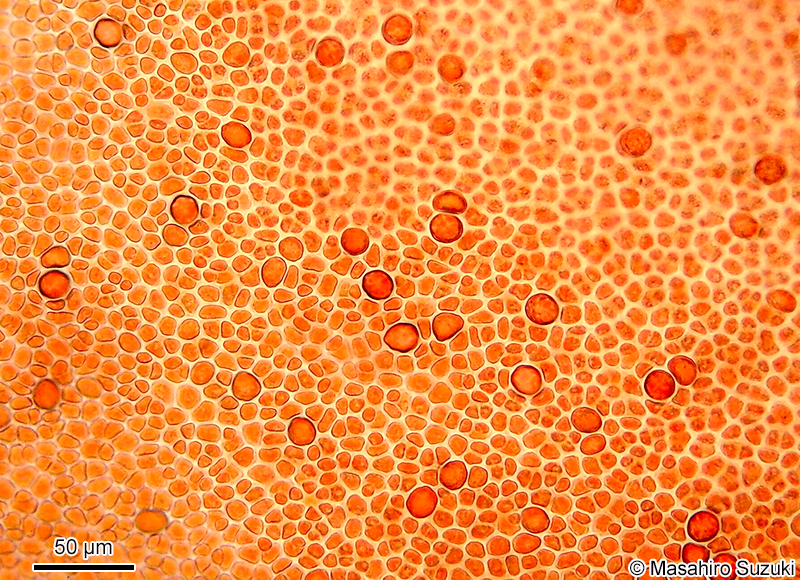 四分胞子嚢を付けた体の表面観