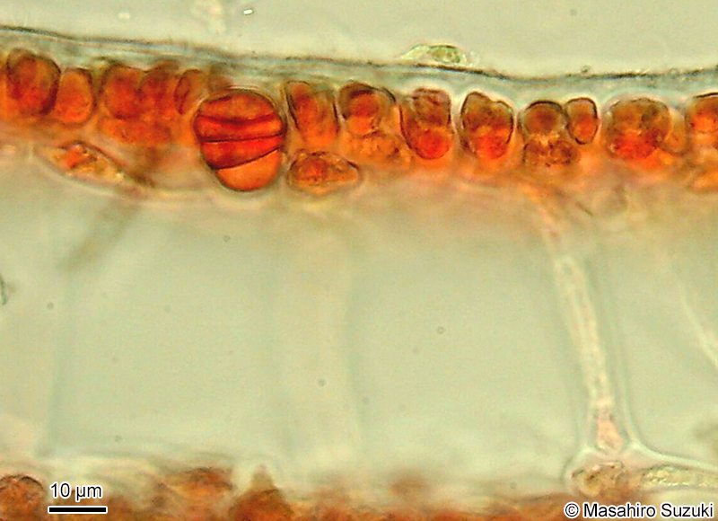 環状に分裂した四分胞子嚢