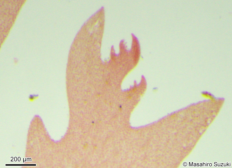 2対の小羽枝を生じた個体