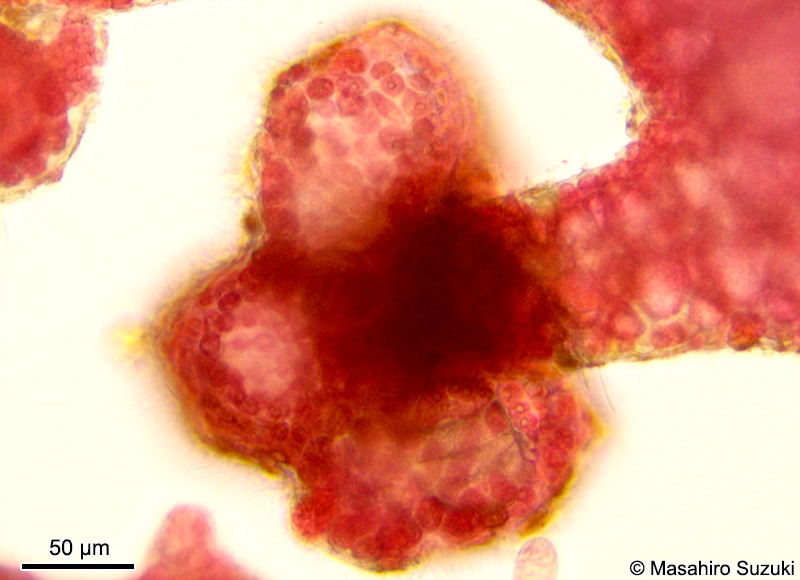 スティキディアに形成された四分胞子嚢