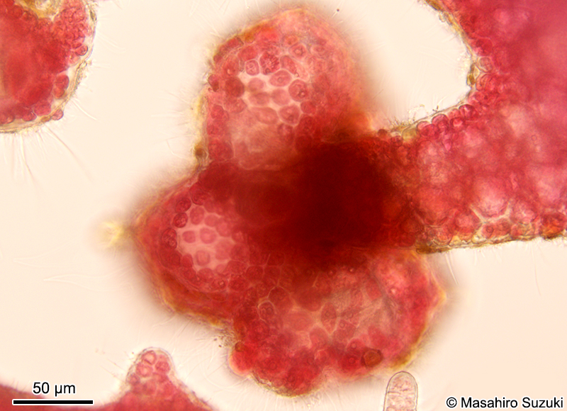 スティキディアの表面観