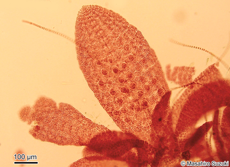 Reinboldiella taiwanensis