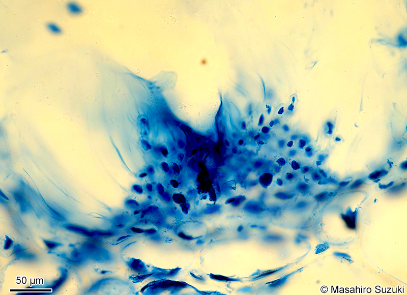 ‘réseau muqueux’