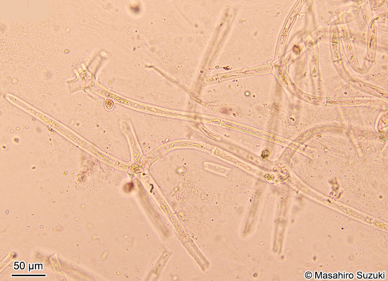 内層部の糸状細胞