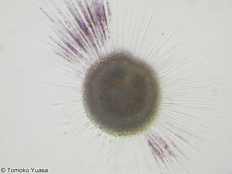 Spongodiscus biconcavus