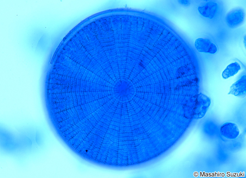 クモノスケイソウ Arachnoidiscus ehrenbergii