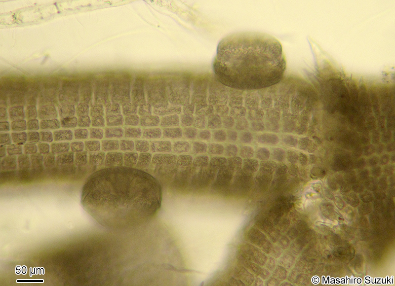 クモノスケイソウ Arachnoidiscus ehrenbergii