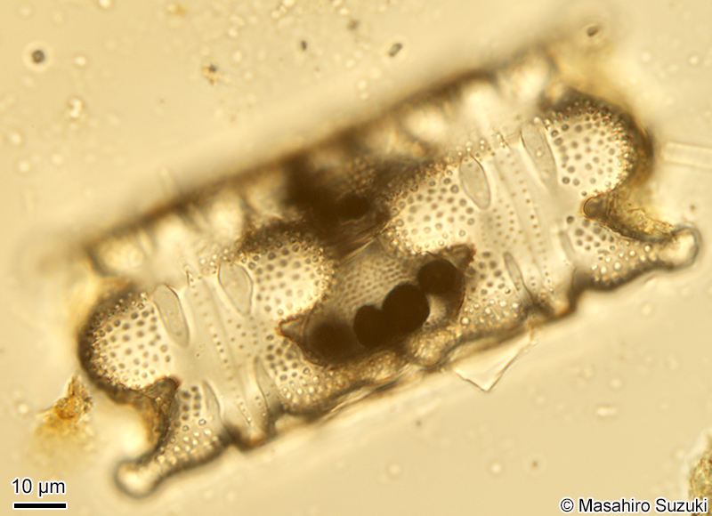 イトマキケイソウ Biddulphia biddulphiana