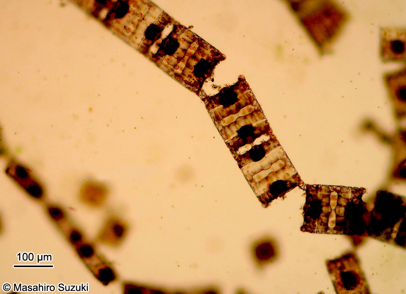 イトマキケイソウ Biddulphia biddulphiana