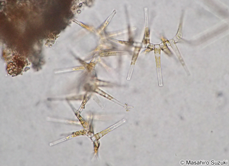 マメホシガタケイソウ Bleakeleya notata