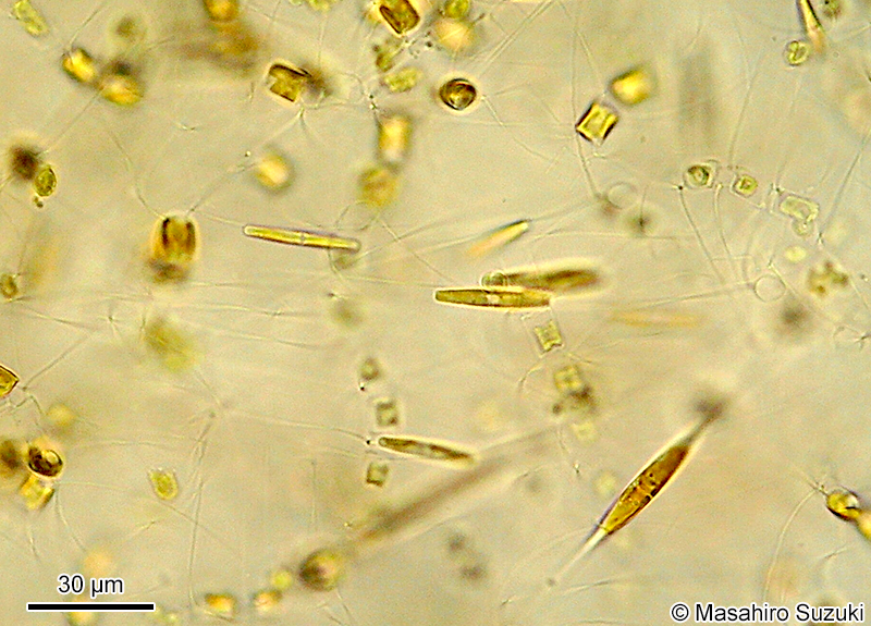 ムレツノケイソウ Chaetoceros socialis
