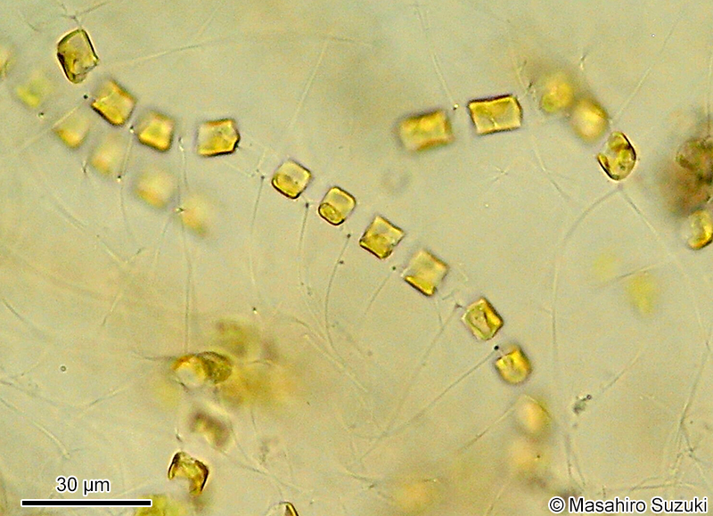 ムレツノケイソウ Chaetoceros socialis