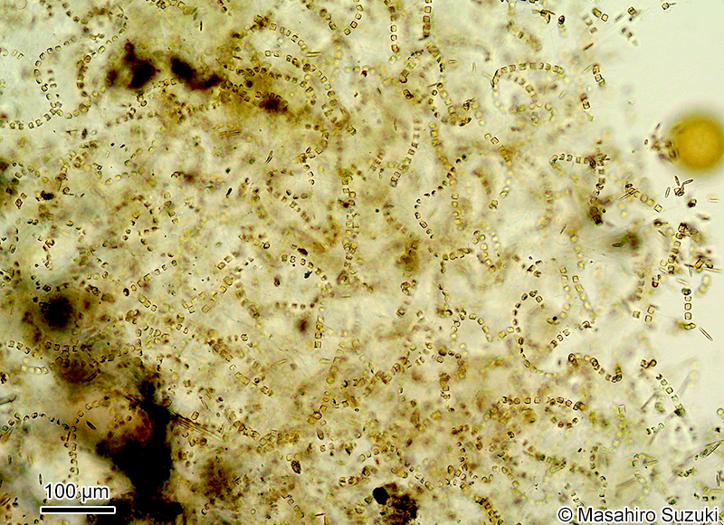 ムレツノケイソウ Chaetoceros socialis