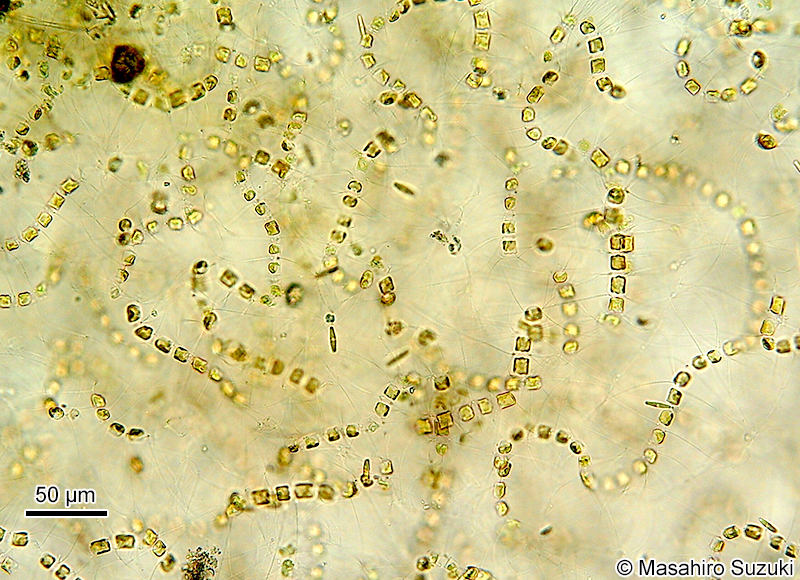 ムレツノケイソウ Chaetoceros socialis