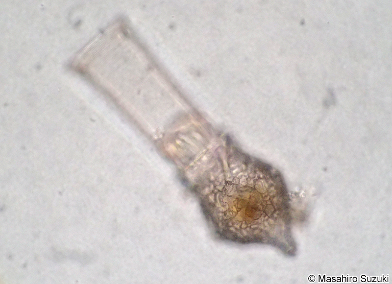 Codonellopsis orthoceras