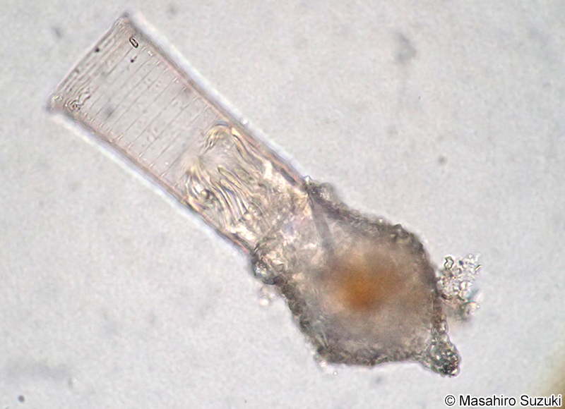 Codonellopsis orthoceras