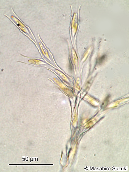 ヒダサヤツナギ Dinobryon divergens