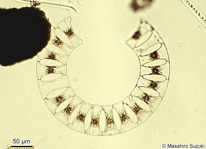 ハシゴケイソウ Eucampia zodiacus